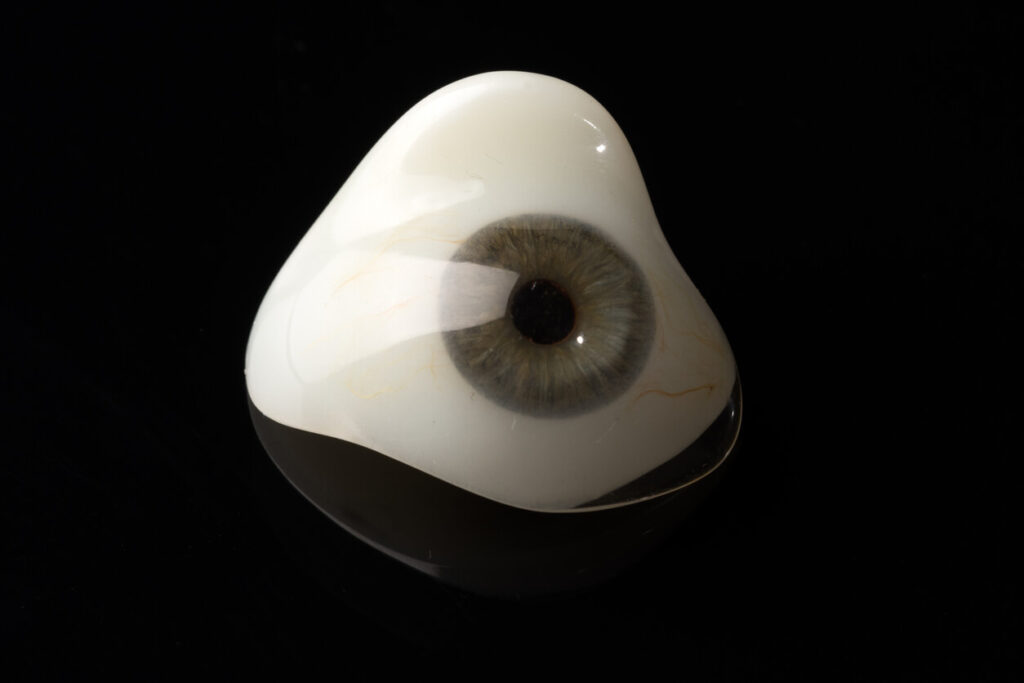 Scleral Shell vs Prosthetic Eye: Which One Do You Need?